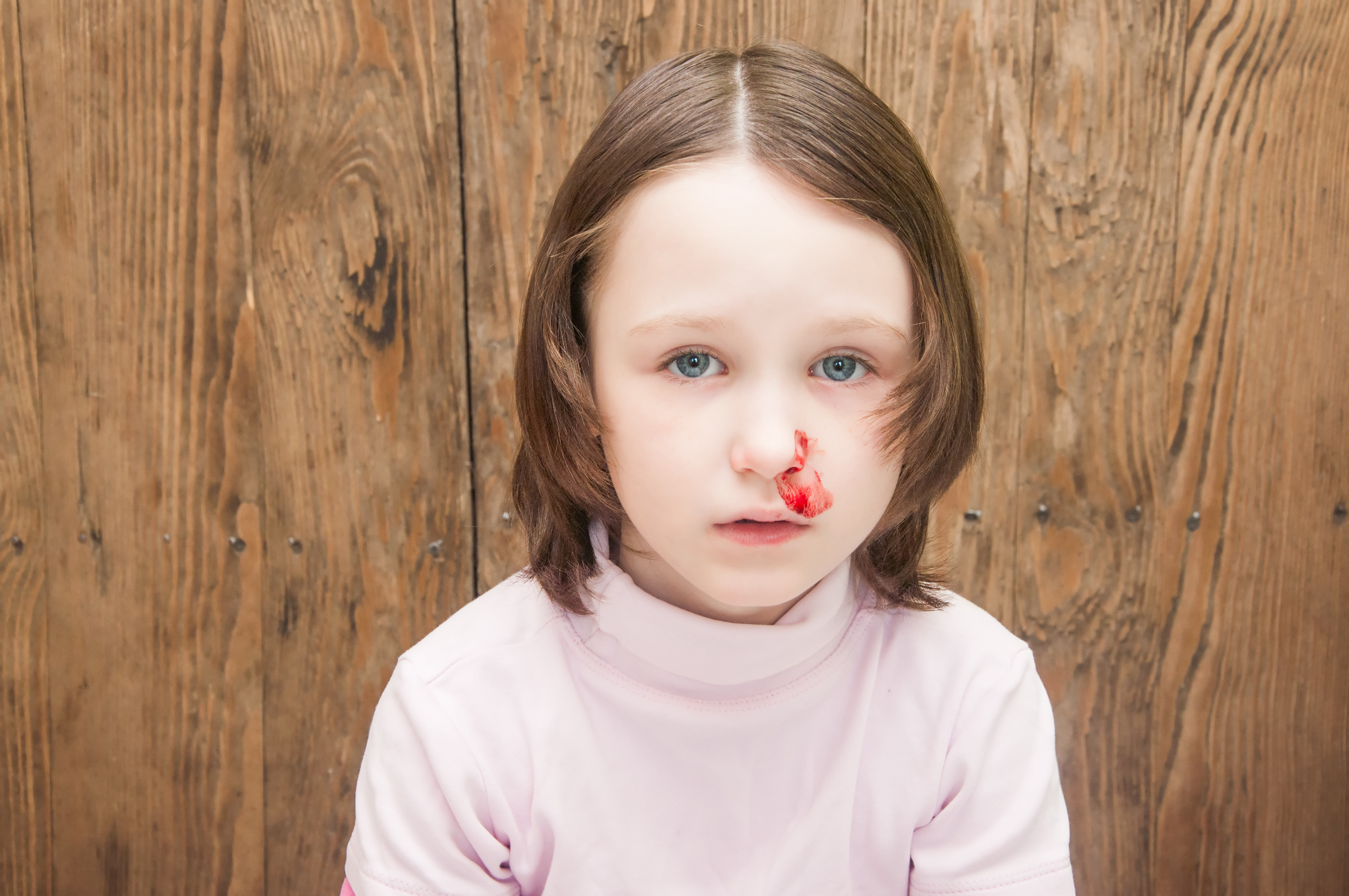 Кровь из носа у ребенка 2 года