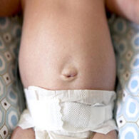 Newborn's Umbilical Cord/Belly Button